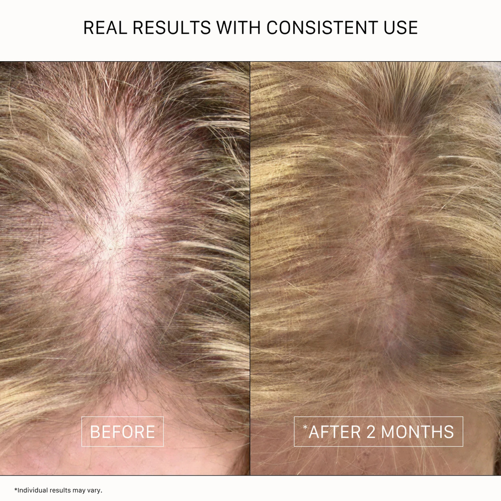 DUO RECOVER - SHAMPOOING ET REVITALISANT ÉPAISSISSANT POUR FEMME