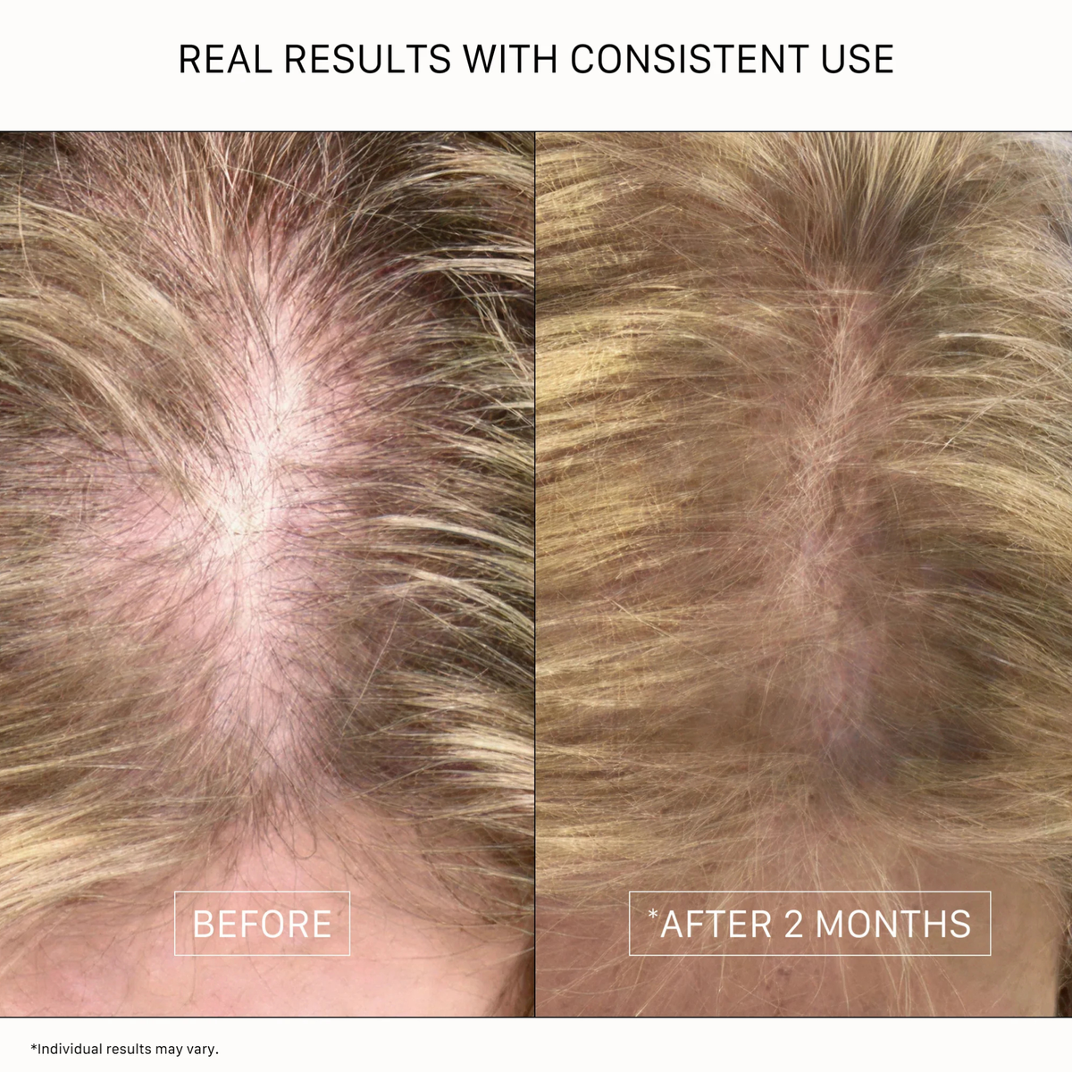 RECOVER DUO - THICKENING SHAMPOO AND CONDITIONER FOR WOMEN