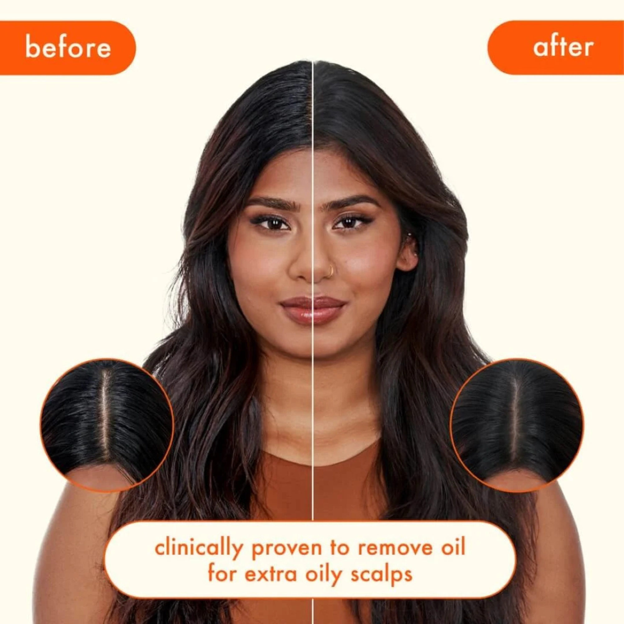 PERK UP ULTRA - SEBUM-REGULATING DRY SHAMPOO